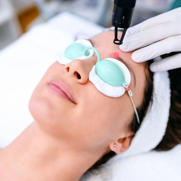 Image of woman getting laser